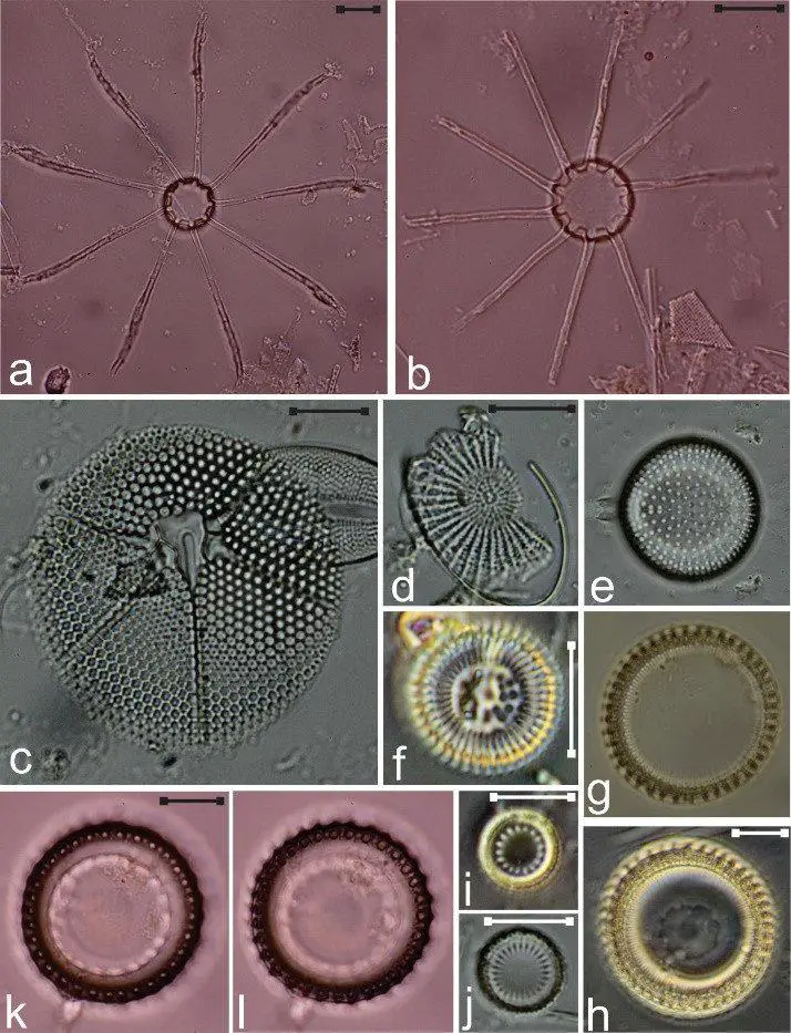 a-b-Bacteriastrum-hyalinum-c-Asteromphalus-arachne-d-Cyclostephanos-sp-e.jpg