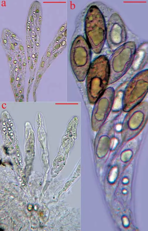 a-c-Schizothecium-simile-a-c-16-spored-asci-with-immature-spores-in-different-stages.png