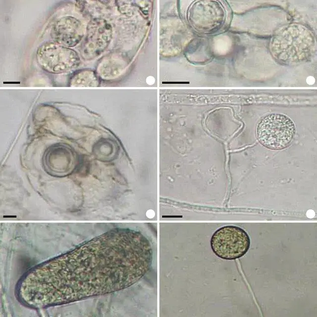 a-f-Oomycetes-in-the-Acude-Joana-Complex-Pedro-II-Piaui-Brazil-a-c-Myzocytiopsis_Q640.jpg