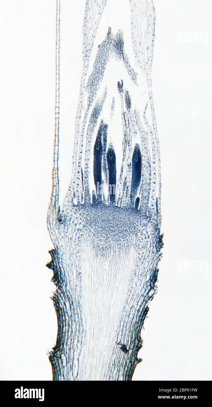 moos-archegonia-abschnitt-2bp91fw.jpg