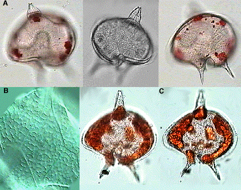 protoperidinium_depressum.gif