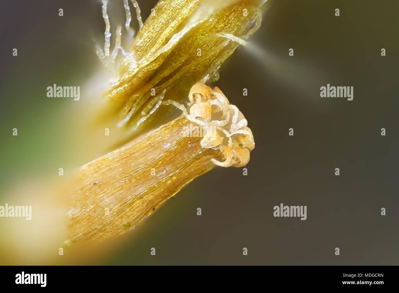 spore-capsule-of-lanceolateleaf-rock-moss-orthotrichum-speciosum-a-microscope-image-MDGCRN.jpg