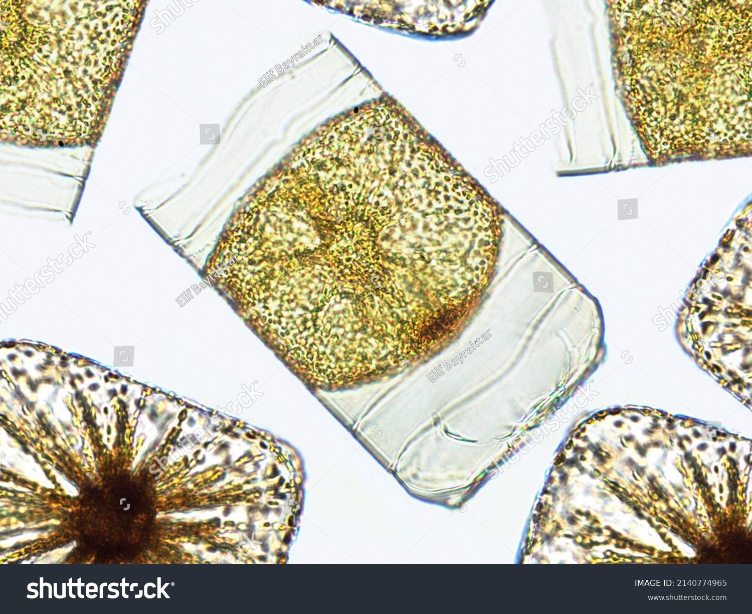 stock-photo-algae-under-microscopic-view-chrysophyte-diatoms-phytoplankton-fossils-silica-golden-yellow-2140774965.jpg