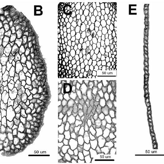 Anatomy-of-Meteoriella-soluta-and-Loeskeobryum-brevirostre-A-B-a-portion-of-the-stem_Q640.jpg