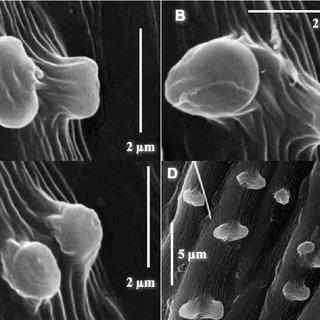 Baggy-papillae-forming-twins-in-Taxithelium-planum_Q320.jpg