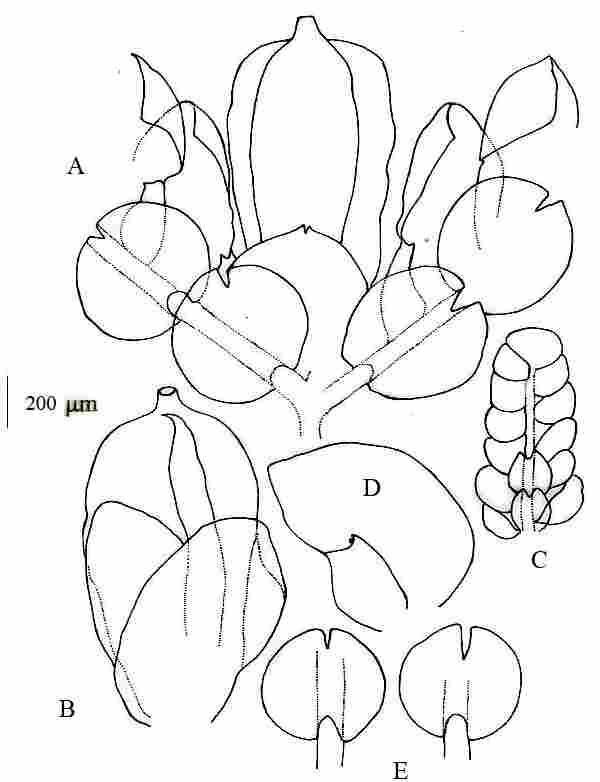 Cheilolejeunea-ruwenzorensis-Steph-RMSchust-A-Perianth-ventral-view-showing.jpg