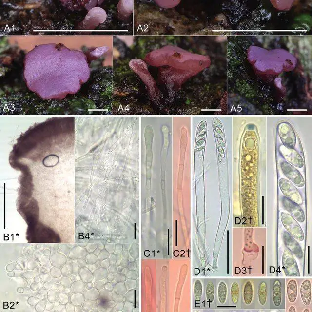 Morphological-features-of-Ascocoryne-sarcoides-A-apothecia-B-excipular-tissues-in_Q640.jpg