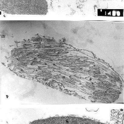 TEM-analysis-of-chloroplast-of-Taxithelium-nepalense-with-or-without-Pb-and-As-a_Q640.jpg